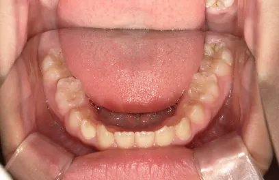 治療前