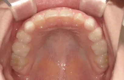 治療後