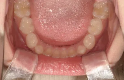 治療後